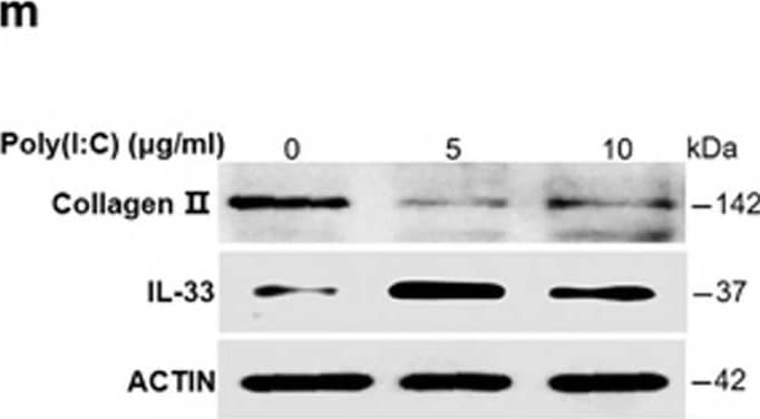 dsRNA released from damaged cartilages activates TLR3 to induce IL-33 expression. (a–d) Quantification of Il-33 (b), Mmp-1 (c), and Mmp-13 (d) expression in normal human chondrocytes induced by the supernatant of osteoarthritic cartilage tissue homogenates in human chondrocytes transfected with or without Tlr3-siRNA. D-supernatant represents supernatant from damaged cartilage lysate. (e–h) Quantification of Il-33 (f), Mmp-1 (g), and Mmp-13 (h) expression in normal human chondrocytes induced by the supernatant of osteoarthritic cartilage tissue homogenates in human chondrocytes transfected with or without Tlr7 siRNA. D-supernatant represents supernatant from damaged cartilage lysate. (i–l) Quantification of Il-33 (i), Mmp-1 (j), Mmp-13 (k) and collagen II (l) expression in normal human chondrocytes induced by different doses of poly(I:C) for 24 h. (m) Western blot analysis of IL-33 and type II collagen in human chondrocytes induced by different doses of poly(I:C) for 24 h. *P<0.05, **P<0.01, and ***P<0.001. P-values were analyzed by one-way ANOVA Image collected and cropped by CiteAb from the following open publication (//pubmed.ncbi.nlm.nih.gov/29095435), licensed under a CC-BY license. Not internally tested by R&D Systems.