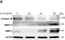 IL-33 increases MMP-1 and MMP-13 expression in chondrocytes. (a–c) Dose-dependent expression of Mmp-1 (a), Mmp-13 (b), and type II collagen (c) induced by IL-33 in human chondrocytes. (d) Western blot of MMP-1, MMP-13, and type II collagen expression in human chondrocytes induced by different doses of IL-33. (e and f) Quantification of Mmp-1 (e) and Mmp-13 (f) expression in mouse cartilage tissues 24 or 48 h after IL-33 intra-articular injection. (g) Immunohistochemical analysis of type II collagen expression in mouse articular tissues 48 h after IL-33 intra-articular injection. (h) Safranin O staining of mouse articular tissues 48 h after IL-33 intra-articular injection. Scale bar represents 100 μm. **P<0.01 and ***P<0.001. P-values were analyzed by one-way ANOVA Image collected and cropped by CiteAb from the following open publication (//pubmed.ncbi.nlm.nih.gov/29095435), licensed under a CC-BY license. Not internally tested by R&D Systems.