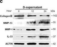 RNAs released from injured osteoarthritic cartilages induce IL-33 expression in normal human chondrocytes. (a) TUNEL immunofluorescent staining in normal and osteoarthritic cartilage tissue slices. Scale bar represents 50 μm. (b) Western blot analysis of cleaved caspase-3 in normal and osteoarthritic cartilages. Samples from four OA patients were pooled together. (c) Western blot for IL-33, MMP-1, MMP-13, and type II collagen expression in normal human chondrocytes treated with the supernatants of osteoarthritic cartilage tissue homogenates. D-supernatant represents supernatant from damaged cartilage lysate. (d–g) Quantification of Il-33 (d), Mmp-1 (e), and Mmp-13 (f) and collagen II (g) expression in normal human chondrocytes induced by the supernatant of damaged cartilage lysate at different time points. (h) Western blot analysis for IL-33, MMP-1, and MMP-13 induced by the supernatant of osteoarthritic cartilage tissue homogenates in human chondrocytes pretreated with or without 5 μg/ml RNase A. D-supernatant represents supernatant from damaged cartilage lysate. (i–k) Quantification of Il-33 (i), Mmp-1 (j), and Mmp-13 (k) expression in normal human chondrocytes induced by the supernatant of osteoarthritic cartilage tissue homogenates in human chondrocytes pretreated with or without 5 μg/ml RNase A. D-supernatant represents supernatant from damaged cartilage lysate. **P<0.01 and ***P<0.001. P-values were analyzed by one-way ANOVA Image collected and cropped by CiteAb from the following open publication (//pubmed.ncbi.nlm.nih.gov/29095435), licensed under a CC-BY license. Not internally tested by R&D Systems.