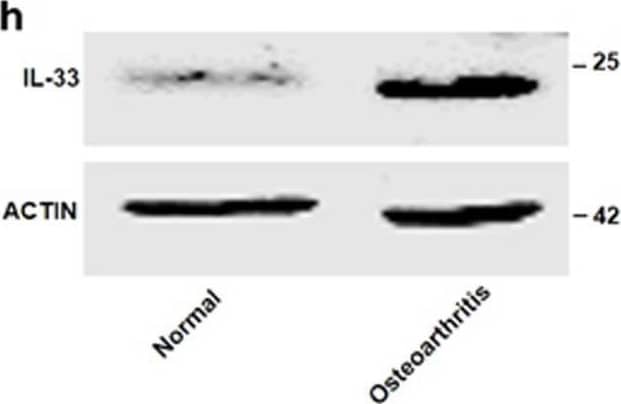 IL-33 expression is increased in the articular chondrocytes of osteoarthritic patients. (a–c) Quantification of Il-33 (a), Mmp-1 (b), and Mmp-13 (c) expression in articular tissues from normal and osteoarthritic patients. (d) Immunohistochemical analysis of IL-33 expression in articular tissue from normal and osteoarthritic patients. Scale bar represents 20 μm. (e–g) Quantification of IL-33 (e), MMP-1 (f), and MMP-13 (g) in normal and osteoarthritic cartilages detected by ELISA. (h) Western blot of IL-33 in normal and osteoarthritic cartilages. (i–k) Quantification of Il-33 (i), Mmp-1 (j), and Mmp-13 (k) expression in normal and osteoarthritic cartilages. (l–n) Quantification of IL-33 (l), MMP-1 (m), and MMP-13 (n) in synovial fluid of normal and osteoarthritic patients detected by ELISA. *P<0.05, **P<0.01, and ***P<0.001. P-values were analyzed by t-test Image collected and cropped by CiteAb from the following open publication (//pubmed.ncbi.nlm.nih.gov/29095435), licensed under a CC-BY license. Not internally tested by R&D Systems.