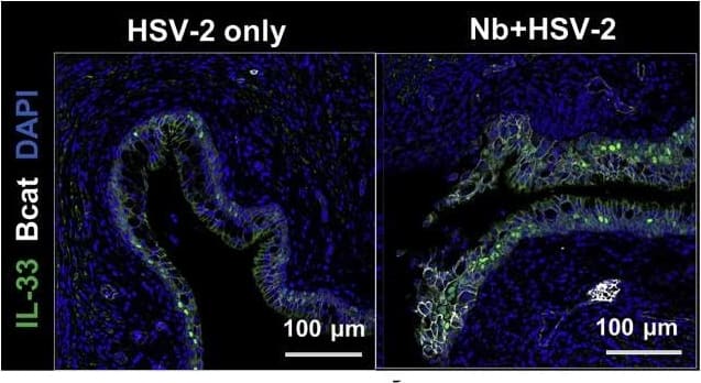 Prior Nb exposure results in earlier and exacerbated HSV-2 pathology. (I and J) (I) Vaginal IL-33 measured by ELISA (day 2) and (J) IF staining of vaginal tissue (day 3; n = 4). Data are representative of two independent experiments with 4–6 mice per group (mean ± SEM). Statistical significance was calculated by two-way analysis of variance (ANOVA) with Bonferroni correction for multiple comparisons and Mann-Whitney t test. ∗p ≤ 0.05, ∗∗p ≤ 0.01, ∗∗p ≤ 0.01, ∗∗∗p ≤ 0.001, ns, not significant. Image collected and cropped by CiteAb from the following publication (//pubmed.ncbi.nlm.nih.gov/33857419), licensed under a CC-BY license. Not internally tested by R&D Systems.