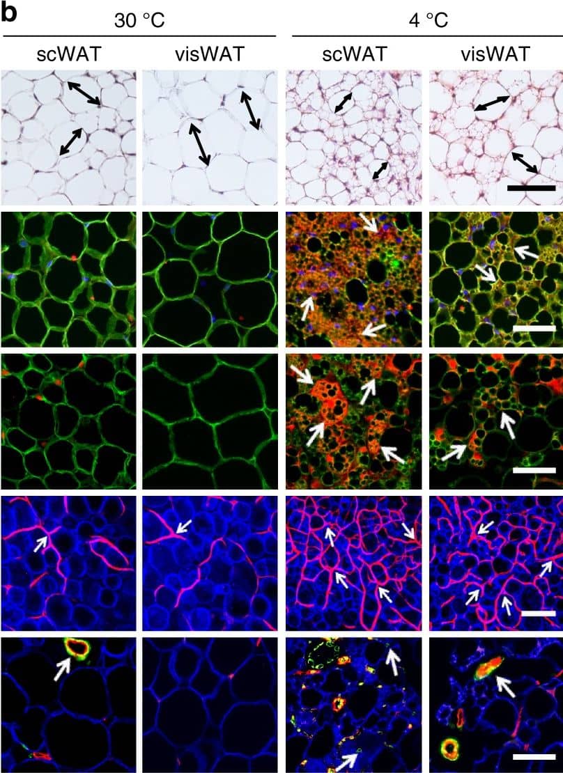 <b>Biological Strategies Validation. </b>CL and low temperature lead to WAT browning, angiogenesis, and an increased number of myofibroblast-like cells. a, b Histological analysis of adipocyte morphology (H&E), adipocytes (PERI), mitochondria (COX4), uncoupling protein 1 (UCP1), blood vessels (CD31), and myofibroblast-like cells ( alpha SMA) in a 5-day CL-316243-treated scWAT and visWAT compared to vehicle-treated control. b Two-week 4 °C-treated scWAT and visWAT compared to 30 °C control. Double-headed arrows mark adipocyte diameter. Arrows point to respective positive signals. c–l Quantifications of adipocyte size and positive signals per field of COX4, UCP1, CD31, and  alpha SMA of CL-316243- and vehicle-, and 30 °C- and 4 °C- treated scWATs and visWATs (>30 adipocytes per field; n = 10 random fields; n = 5 mice per group). PERI, perilipin; COX4, mitochondrial complex 4; UCP1, uncoupling protein 1. Scale bars, 100 μm. NS, not significant. *P < 0.05, **P < 0.01, and ***P < 0.001 by Student’s t-test. Data presented as mean ± s.e.m. Image collected and cropped by CiteAb from the following publication (//www.nature.com/articles/s41467-017-02158-z), licensed under a CC-BY license. Not internally tested by R&D Systems.