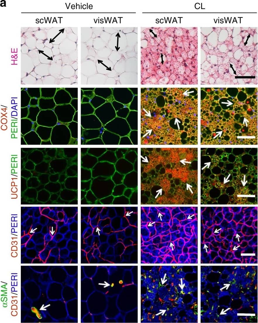 <b>Biological Strategies Validation. </b>CL and low temperature lead to WAT browning, angiogenesis, and an increased number of myofibroblast-like cells. a, b Histological analysis of adipocyte morphology (H&E), adipocytes (PERI), mitochondria (COX4), uncoupling protein 1 (UCP1), blood vessels (CD31), and myofibroblast-like cells ( alpha SMA) in a 5-day CL-316243-treated scWAT and visWAT compared to vehicle-treated control. b Two-week 4 °C-treated scWAT and visWAT compared to 30 °C control. Double-headed arrows mark adipocyte diameter. Arrows point to respective positive signals. c–l Quantifications of adipocyte size and positive signals per field of COX4, UCP1, CD31, and  alpha SMA of CL-316243- and vehicle-, and 30 °C- and 4 °C- treated scWATs and visWATs (>30 adipocytes per field; n = 10 random fields; n = 5 mice per group). PERI, perilipin; COX4, mitochondrial complex 4; UCP1, uncoupling protein 1. Scale bars, 100 μm. NS, not significant. *P < 0.05, **P < 0.01, and ***P < 0.001 by Student’s t-test. Data presented as mean ± s.e.m. Image collected and cropped by CiteAb from the following publication (//www.nature.com/articles/s41467-017-02158-z), licensed under a CC-BY license. Not internally tested by R&D Systems.