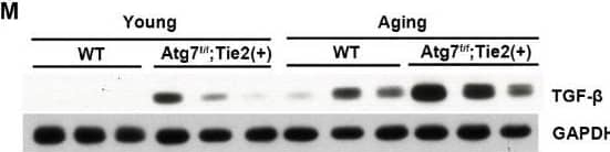 Increase in renal fibrosis in aging kidneys of Atg7flox/flox;Tie2-Cre+ mice. (A) Representative immunoblots and densitometry for the expression of Atg7. (B) Relative protein level of Atg7 (%). (C) Representative images of H&E staining from wild-type and Atg7flox/flox;Tie2-Cre+ mice. Scale bars, 100 μm. (D) Quantification of glomeruli diameters (µm). (E) Representative 3,3′-diaminobenzidine (DAB) staining for CD31. Scale bars, 50 μm. (F) Quantification of capillary lumen diameters (µm). (G) Representative immunoblots and densitometry for the expression of CD31. (H) Relative protein levels of CD31 (%). (I) Masson’s trichrome staining from wild-type and Atg7flox/flox;Tie2-Cre mice, showing the cortex and medulla with increased extracellular matrix deposition in the aging Atg7flox/flox;Tie2-Cre+ mouse. (J) Quantification of tubulointerstitial fibrosis (%). (K) Representative DAB staining for TGF-beta . (L) Quantification of TGF-beta  positive areas (%). (M) Representative immunoblots and densitometry for expression of TGF-beta . (N) Relative protein level of TGF-beta  (%). (O) Representative DAB staining for  alpha -SMA. (P) Quantification of  alpha -SMA-positive areas (%). (Q) Representative immunoblots and densitometry for expression of  alpha -SMA. (R) Relative protein levels of  alpha -SMA (%). Scale bars, 50 μm for cortex and 100 μm for medulla. Values are means ± SEM. *, p < 0.05; **, p < 0.01; ***, p < 0.001; ****, p < 0.0001, ns: not significant. Image collected and cropped by CiteAb from the following open publication (//www.mdpi.com/2076-3921/13/8/886), licensed under a CC-BY license. Not internally tested by R&D Systems.