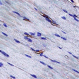 CD31/PECAM‑1 was detected in immersion fixed paraffin-embedded sections of rat heart using Goat Anti-Human/Mouse/Rat CD31/PECAM‑1 Antigen Affinity-purified Polyclonal Antibody (Catalog # AF3628) at 3 &micro;g/mL for 1 hour at room temperature followed by incubation with the Anti-Mouse IgG VisUCyte&trade; HRP Polymer Antibody (VC001). Before incubation with the primary antibody, tissue was subjected to heat-induced epitope retrieval using Antigen Retrieval Reagent-Basic (CTS013). Tissue was stained using DAB (brown) and counterstained with hematoxylin (blue). Specific staining was localized to endothelial cells in vasculature.