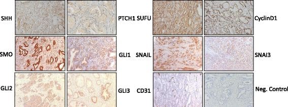 Representative images of positive IHC staining in benign and malignant prostate tissue and a negative control Image collected and cropped by CiteAb from the following open publication (//pubmed.ncbi.nlm.nih.gov/28877722), licensed under a CC-BY license. Not internally tested by R&D Systems.