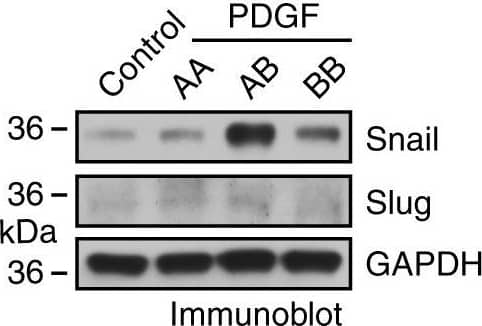 PDGF-AB induces Endo-MT through NF-kB-mediated Snail expression in ECs. a Human brain microvacular ECs were treated with glioma-CM. RNA was isolated and subjected to RNA-seq analysis. Left, heat map for expression of EMT-related transcriptional factors. Right, fold change of these transcriptional factors (n = 3, mean ± SEM). b, c ECs were treated with 100 ng/ml PDGF-AA, PDGF-AB, and PDGF-BB. b Cell lysates were immunoblotted. c RNA was isolated and analyzed by RT-PCR. Results were normalized with GAPDH levels (n = 3, mean ± SEM). d ECs were transfected with siRNAs targeting Snail or control scrambled sequence, and treated with PDGF-AB. Cell lysates were immunoblotted. e ECs were transfected with siRNAs targeting Erg-1, NF-kappa B, or control scrambled sequence, and treated with PDGF-AB. Cell lysates were immunoblotted. f ECs were treated with PDGF-AB for 2 h. Cells were analyzed by immunofluorescence. g, h ECs were treated with PDGF-AB or control medium for 8 h. Nuclear extracts were immunoprecipitated with anti-NF-kappa B antibody or IgG, and subjected to ChIP analysis with primers #1 and #2. g DNA was resolved by agarose electrophoresis, and imaged. Shown are representative results with primer #2. The arrow indicates the amplified DNA in Snail promoter. h Quantitative PCR analysis (n = 3, mean ± SEM). i ECs were transfected with siRNAs targeting Snail or control scrambled sequence, 4 days after treatment with Ki8751, followed by cell viability analysis (n = 3, mean ± SD) Image collected and cropped by CiteAb from the following open publication (//pubmed.ncbi.nlm.nih.gov/30150753), licensed under a CC-BY license. Not internally tested by R&D Systems.