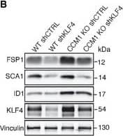 KLF4 regulates the EndMT switch in CCM1 KO ECsA–DCultured lung‐derived WT and CCM1 KO ECs were lentivirally transduced with shRNA directed to either Klf4 (shKLF4) or control sequence (shCTRL). (A) qRT–PCR of mesenchymal (Fsp1, Id1), stem cell‐like (Sca1), and endothelial markers (VE‐cadherin and Claudin5) in WT shCTRL, WT shKLF4, CCM1 KO shCTRL, and CCM1 KO shKLF4 ECs. Data are mean ± SD (n = 3). Fold difference in gene expression is relative to WT shCTRL ECs. A two‐tailed unpaired t‐test was performed. Klf4: ****P < 0.00001, ***P = 0.0008, **P = 0.007; Fsp1: ***P = 0.0001, ****P = 3.9E‐05, ###P = 0.0002; Sca1: ***P = 0.0001, ****P < 0.00001; Id1: ***P = 0.0001; Ve‐cadherin: ***P = 0.0001; Claudin5: ****P = 1.37E‐05. (B) WB of EndMT markers in WT shCTRL, WT shKLF4, CCM1 KO shCTRL, and CCM1 KO shKLF4 ECs. Vinculin is the loading control. These data are representative of three independent observations. (C) Proliferation rate of WT shCTRL, WTshKLF4, CCM1 KO shCTRL, and CCM1 KO shKLF4 ECs cultured for 5 days. Columns represent mean ± SD (n = 8). A two‐tailed unpaired t‐test was performed. 3 days of culture: ***P = 0.0001, **P = 0.0045, ##P = 0.0017; 5 days of culture: ***P = 0.0001, **P = 0.0029, ##P = 0.0040. (D) Migration rate measured in a wound assay of WT shCTRL, CCM1 KO shCTRL, and CCM1 KO shKLF4 ECs. Mean ± SD is shown (n = 6). A two‐tailed unpaired t‐test was performed. ***P = 0.0004, ###P = 0.0009.ECultured lung‐derived WT ECs were lentivirally transduced with a full‐length murine Klf4 (LentiKLF4) or empty vector (Mock). qRT–PCR (left panel) and WB (right panel) of EndMT markers in Mock and LentiKLF4 ECs. qRT–PCR data are mean ± SD (n = 3) and the fold changes are relative to Mock ECs. A two‐tailed unpaired t‐test was performed. **P = 0.002, ***P = 0.0007, ###P = 0.0001. WB results are representative of three independent observations. Tubulin is the loading control.Source data are available online for this figure. Image collected and cropped by CiteAb from the following publication (//pubmed.ncbi.nlm.nih.gov/26612856), licensed under a CC-BY license. Not internally tested by R&D Systems.