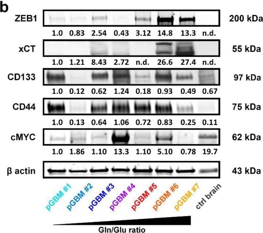 High Gln/Glu ratios predict ZEB1 and xCT expression in primary GBM tumors. (a) Expanded regions from 1H-NMR spectra showing Gln and Glu multiplets of metabolic extracts from seven primary glioblastoma (pGBM) patient samples. Spectra were normalized to the Glu content to visualize the differences in Gln/Glu ratios. (b) Immunoblotting of ZEB1, xCT, CD133, CD44, and cMYC protein in GBM patient samples arranged according to their Gln/Glu ratios in ascending order (loading control =  beta  actin). A non-neoplastic brain sample of a trauma patient was blotted as a control. Abbreviations: ctrl, control; Gln, glutamine; Glu, glutamate; n.d., not detectable; pGBM, primary glioblastoma; ppm, parts per million. Supplementary Figures 5 (S5) and 6 (S6) correspond to Figure 5b. Image collected and cropped by CiteAb from the following open publication (//pubmed.ncbi.nlm.nih.gov/34885110), licensed under a CC-BY license. Not internally tested by R&D Systems.