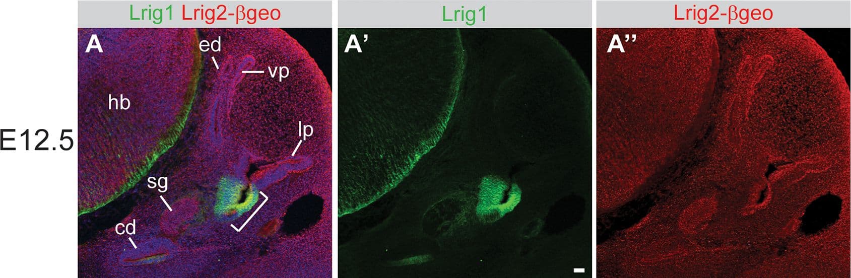 Lrig1 and Lrig2-beta geo are co-expressed in non-sensory tissues and in the vestibular ganglion.Transverse sections through Lrig2+/− tissue at E12.5 (A–C), E16.5 (D–G), and P15 (H–K) were double labeled with combinations of antibodies to Lrig1,  beta -galactosidase (to detect Lrig2-beta geo), Sox2, and neurofilament (NF). (A) At E12.5, Lrig1 was detected in the atrium (bracket), while Lrig2-beta geo was present throughout the otic epithelium and surrounding mesenchyme (A″), overlapping with Lrig1 in the atrium (B). Within the atrium, Lrig1 was present in non-sensory tissues that flank Sox-2 positive sensory regions (arrowheads, C–C″). This expression was maintained at E16.5, with Lrig1 in the transitional epithelium adjacent to the utricular macula (arrowhead, D′) and in the extramacular epithelium of the saccule (arrowhead, F′), as well as in vestibular projections to the utricle and lateral crista (arrow, D′). Lrig2-beta geo, on the other hand, continued to be expressed broadly in both sensory and non-sensory portions of the vestibular organs at E16.5 (E′, G′). After the onset of hearing (P15), Lrig1 was expressed in NF-positive fibers innervating the utricular and saccular maculae (arrows, I, J), whereas Lrig2-beta geo was enriched in all vestibular sensory epithelia (I′,J′,K), which were recognized by the presence of NF labeled projections. c = crista, cd = cochlear duct, ed = endolymphatic duct, hb = hindbrain, lp = lateral pouch, sg = spiral ganglion, sm = saccular macula, um = utricular macule, vg = vestibular ganglion, vp = vertical pouch, VIIIV = vestibular division of the eighth cranial nerve. Scale bar = 40 µm. Image collected and cropped by CiteAb from the following publication (//pubmed.ncbi.nlm.nih.gov/24086156), licensed under a CC-BY license. Not internally tested by R&D Systems.