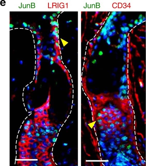 JunB expression during skin maturation and upon stress. a Representative microphotographs with double immunostaining for JunB (green) and FABP5 (red), indicative of sebaceous glands, in skin derived from 1, 3, and 5 days old mice. Inset showing magnified view of a sebaceous gland. Scale bars, 50 µm. b Immunostaining of JunB (green) and FABP5 (red) in 60 days old mice. Inset showing magnified view. c Representative microphotographs with double immunostaining of JunB (green) and FABP5 (red) in dorsal skin of 60 days old mice following hair plucking or d after topical TPA application, a potent inducer of proliferation. e Immunostaining of JunB (green) and LRIG1 or CD34 (red) in dorsal skin of 60 days old mice following hair plucking. f Immunostaining of JunB (green) and FABP5 (red) in adult human skin. E, epidermis; D, dermis; HF, hair follicle; SG, sebaceous gland; SD, sebaceous duct; HS, hair shaft. Asterisk indicates hair shaft autofluorescence. Dashed line indicates the epidermal-dermal junction. Scale bars, 50 µm Image collected and cropped by CiteAb from the following publication (//pubmed.ncbi.nlm.nih.gov/30143626), licensed under a CC-BY license. Not internally tested by R&D Systems.