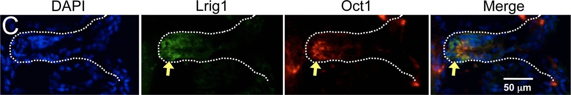 Association of Oct1 with normal somatic stem cells.A. IF images of cross-sections from grossly uninvolved colon margins of a male familial adenomatous polyposis patient. Frozen sections were stained with mouse anti-Oct1 antibodies (Millipore MAB5434) and co-stained with TO-PRO. Crypts are shown in cross-section. White dashed circle highlights a crypt. Arrows indicate cells staining strongly for Oct1. B. IF images of colon crypt sections from a normal male individual. Sections were stained with DAPI, and anti-Oct1 and anti-ALDH1a1 antibodies. Merged images are shown at right. White dashed lines highlight crypts. Examples of cells co-staining with Oct1 and ALDH1a1 are highlighted with yellow arrows. An example cell staining with ALDH1a1 only is highlighted with an asterisk. Inset at lower right-hand corner is a digital magnification of the central portion of the image. Sections were formalin-fixed and paraffin-embedded. C. Frozen mouse colon tissue sections were stained with DAPI, and anti-Lrig1 and anti-Oct1 antibodies. IF images of longitudinal sections are shown. White dashed lines highlight the crypt. D. IF images of mouse small intestine sections. Sections were stained with DAPI and anti-Oct1 antibodies. Merged images are shown at right. White dashed lines highlight a crypt. Inset at upper right-hand corner is a digital magnification of the central portion of the image. Sections were formalin-fixed and paraffin-embedded. E. IF images of cross-sectional duodenum sections from a normal C57BL/6 mouse. Frozen sections were stained with DAPI and anti-Oct1 and anti-Lgr5 antibodies. Merged images are shown at right. Examples of co-staining cells are highlighted with yellow arrows. White dashed lines highlights crypts. F. Longitudinal sections. Image collected and cropped by CiteAb from the following publication (//pubmed.ncbi.nlm.nih.gov/23144633), licensed under a CC-BY license. Not internally tested by R&D Systems.
