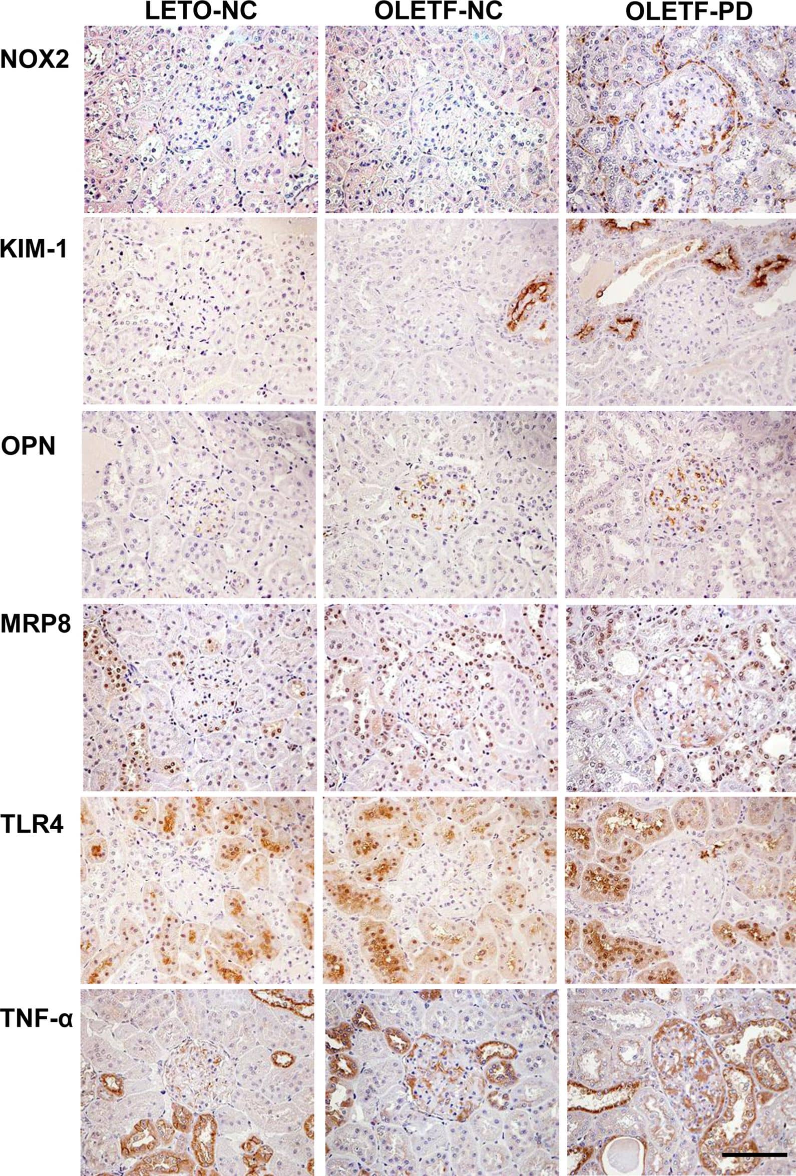 Immunohistochemical analysis of kidneys in LETO and OLETF rats.Representative immunohistochemical images of glomerular, tubular and tubulointerstitial lesions in each group, 12 weeks after starting to feed a Paigen diet. Scale bar, 100 μm. KIM-1, kidney injury molecule-1; MRP8, myeloid-related protein 8; NOX2, NADPH oxidase 2; OPN, osteopontin; TLR4, toll-like receptor 4; TNF-alpha , tumor necrosis factor-alpha . Image collected and cropped by CiteAb from the following publication (//dx.plos.org/10.1371/journal.pone.0143979), licensed under a CC-BY license. Not internally tested by R&D Systems.