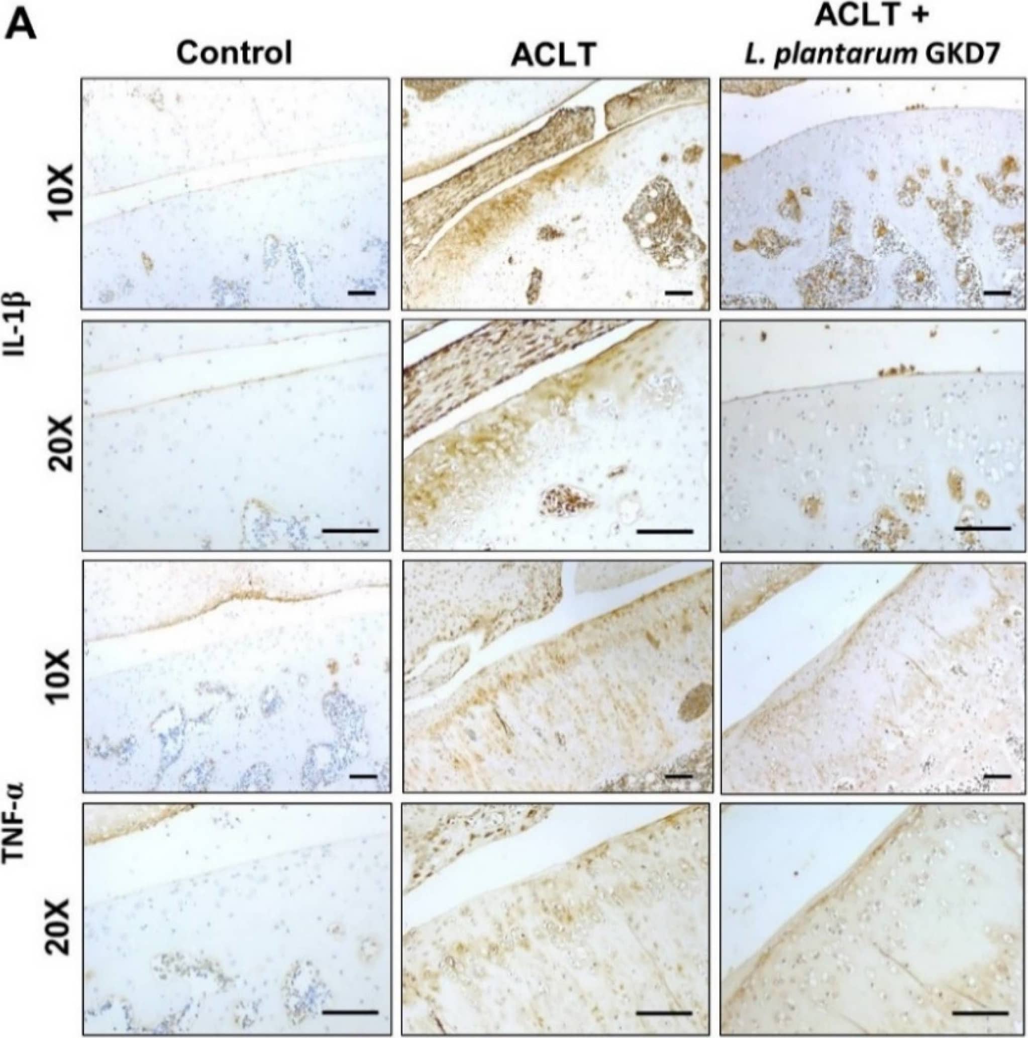 Oral live L. plantarum GKD7 reduced key proinflammatory cytokines in OA cartilage. (A) IHC staining of IL-1 beta  and TNF-alpha  expression in representative cartilage from controls, ACLT-only rats, and ACLT + L. plantarum GKD7 rats. Quantitative analyses of (B) IL-1 beta  and (C) TNF-alpha  in cartilage. Scale bar = 100 µm. * p < 0.05 vs. controls; # p < 0.05 vs. the ACLT-only group. Image collected and cropped by CiteAb from the following open publication (//pubmed.ncbi.nlm.nih.gov/35956346), licensed under a CC-BY license. Not internally tested by R&D Systems.