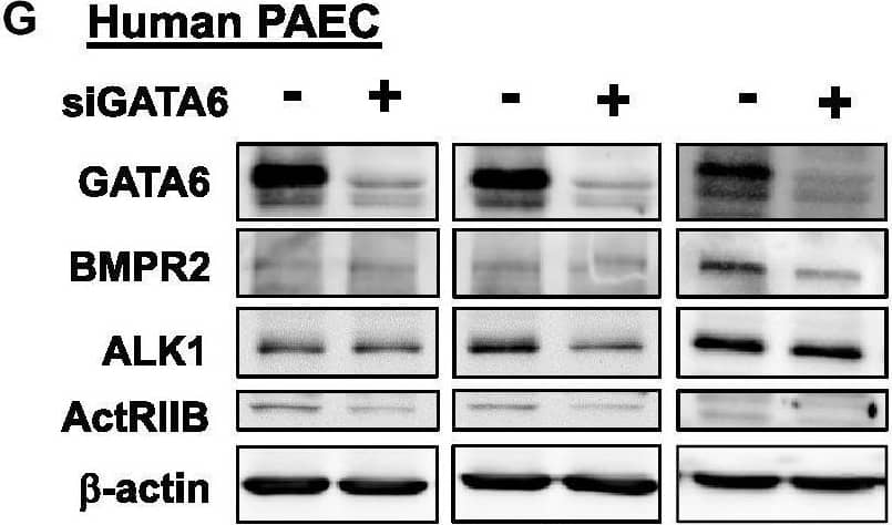 Western Blot ALK-1 Antibody [Unconjugated]