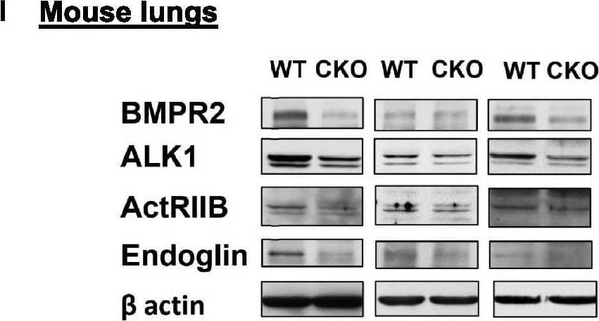 Western Blot ALK-1 Antibody [Unconjugated]
