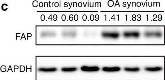 Expression analysis of Fap in OA synovium. a Immunostaining of human FAP in the synovium of control and OA patients. DAPI staining indicates the nucleus. Scale bars: 100 μm. b qPCR analysis of human FAP mRNA levels in the synovium of control and OA patients (n = 8 samples per group). c Western blot analysis of human FAP protein levels in the synovium of control and OA patients (n = 3 samples per group). d Immunostaining of mouse Fap in the knee joint of sham and DMM-treated mice. Sham or DMM surgery was performed in 8-week-old FapLacZ/+ mice, which were sacrificed 8 weeks later, and LacZ immunostaining was used to detect Fap expression at the posterior horn of the medial meniscus (F: femur; T: tibia; M: meniscus; S: synovium). DAPI staining indicates the nucleus. Scale bars: 100 μm. The statistical significance was assessed using two-tailed Student’s unpaired t tests. Data are presented as the mean ± SD (**P < 0.01) Image collected and cropped by CiteAb from the following open publication (//pubmed.ncbi.nlm.nih.gov/36588124), licensed under a CC-BY license. Not internally tested by R&D Systems.