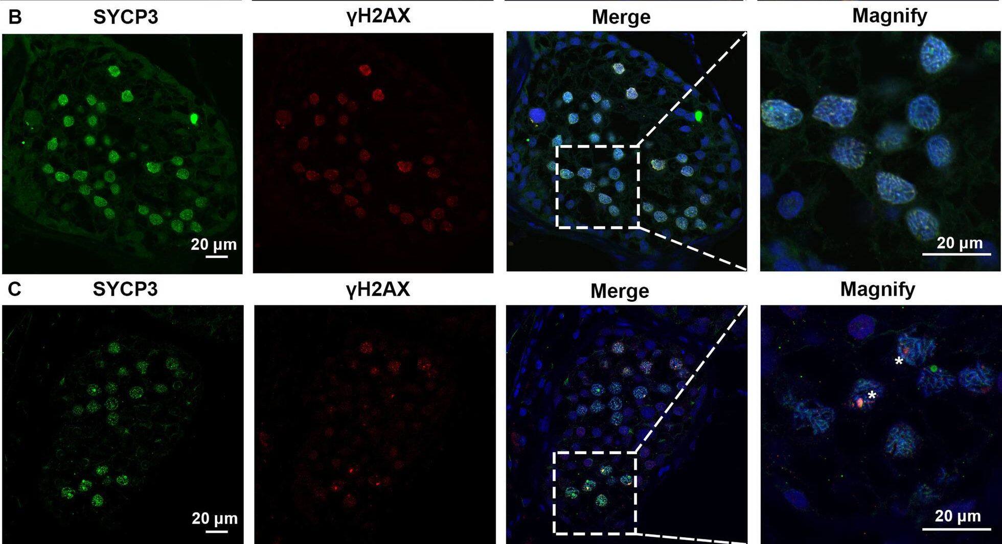 Expression of SYCP3 and  gamma H2AX in the testis of the patient with SYCE1 CNVs and OA-affected patient as a positive control. A–C Immunofluorescence staining showed the expression of SYCP3 (Green) and  gamma H2AX (Red) in the testis of the patient P6326 (A), P10377 (B), and the patient with OA as a positive control (C) Scale bars = 20 μm in A–D. And the arrowhead indicated the XY body in the spermatocytes in the testis of the patient with OA Image collected and cropped by CiteAb from the following open publication (//pubmed.ncbi.nlm.nih.gov/35718780), licensed under a CC-BY license. Not internally tested by R&D Systems.