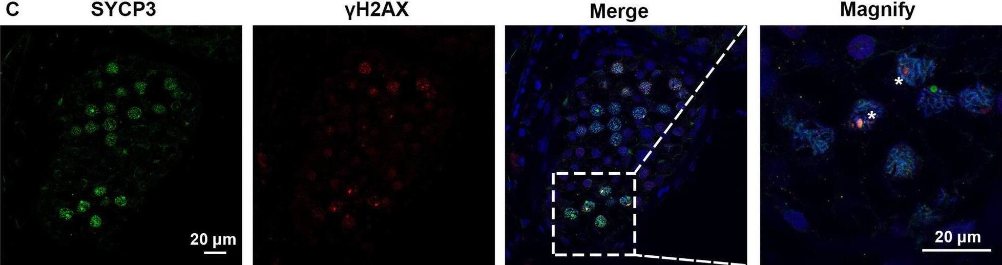 Expression of SYCP3 and  gamma H2AX in the testis of the patient with SYCE1 CNVs and OA-affected patient as a positive control. A–C Immunofluorescence staining showed the expression of SYCP3 (Green) and  gamma H2AX (Red) in the testis of the patient P6326 (A), P10377 (B), and the patient with OA as a positive control (C) Scale bars = 20 μm in A–D. And the arrowhead indicated the XY body in the spermatocytes in the testis of the patient with OA Image collected and cropped by CiteAb from the following open publication (//pubmed.ncbi.nlm.nih.gov/35718780), licensed under a CC-BY license. Not internally tested by R&D Systems.