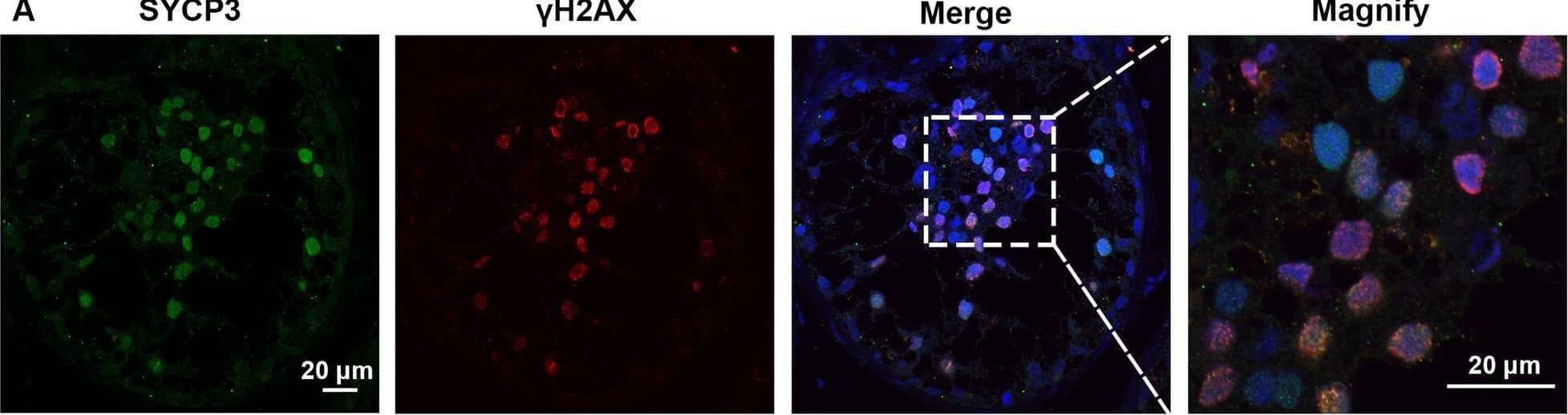 Expression of SYCP3 and  gamma H2AX in the testis of the patient with SYCE1 CNVs and OA-affected patient as a positive control. A–C Immunofluorescence staining showed the expression of SYCP3 (Green) and  gamma H2AX (Red) in the testis of the patient P6326 (A), P10377 (B), and the patient with OA as a positive control (C) Scale bars = 20 μm in A–D. And the arrowhead indicated the XY body in the spermatocytes in the testis of the patient with OA Image collected and cropped by CiteAb from the following open publication (//pubmed.ncbi.nlm.nih.gov/35718780), licensed under a CC-BY license. Not internally tested by R&D Systems.