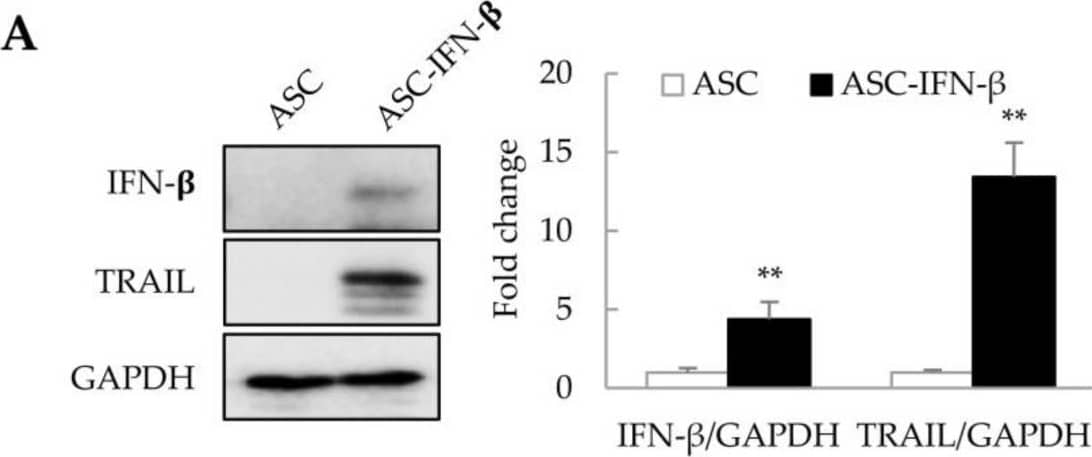 Cell death in liver tumor organoids induced by ASC-IFN-beta . Adipose-derived stem cells (ASCs) were transiently transfected with pCMV3-IFN-beta . IFN-beta  and TRAIL expression was determined via immunoblotting after 1 day. ASC-IFN-beta  was added to liver tumor organoids on day 3, and ASC-IFN-beta -induced viability and cell death in liver tumor organoids were examined on day 4. (A) IFN-beta  and TRAIL expression in ASC-IFN-beta . The intensity of protein expression was quantified through densitometry using ImageJ (National Institutes of Health, //imagej.net/ij/index.html, 10 August 2023), and the relative expression was normalized to that of GAPDH. (B) Suppression of liver tumor organoid viability by ASC-IFN-beta . The viability of organoids was analyzed using the WST-1 assay. (C) Cell death induced by ASC-IFN-beta  in liver tumor organoids. ASC-IFN-beta -induced cell death was evaluated using a live (calcein-AM) and dead (ethidium homodimer-1) assay. In (C), the white boxes indicate areas that have been enlarged to distinguish the staining of the cells. White arrowheads indicate dead cells. Data shown are representative of three independent experiments. * p < 0.05 and ** p < 0.01. Scale bar: 500 µm. Image collected and cropped by CiteAb from the following open publication (//www.mdpi.com/1422-0067/25/2/1325), licensed under a CC-BY license. Not internally tested by R&D Systems.