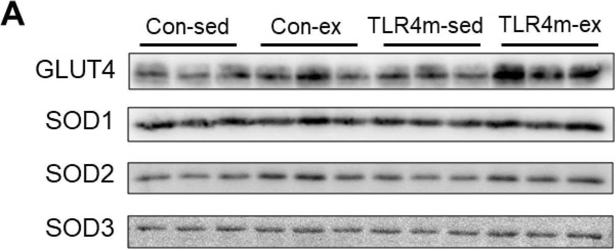 The relative expressions of molecules related to glucose metabolism and oxidative capacity in the plantaris. Glucose transporter 4 (GLUT4) (B), superoxide dismutase 1 (SOD1) (C), SOD2 (D), and SOD3 (E) were measured. Representative images of immunoblots are shown (A). Values are means ± standard error; n = 6 per group. ** p < 0.01 vs. sed within each strain; † p < 0.05 vs. controls within each condition. Image collected and cropped by CiteAb from the following open publication (//pubmed.ncbi.nlm.nih.gov/35163799), licensed under a CC-BY license. Not internally tested by R&D Systems.
