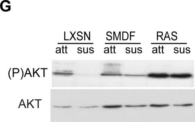 SMDF transforms via ErbB receptor signalling.(A) Western blot analysis of indicated proteins in NSLT cells expressing SMDF, SMDF* (point mutant incapable of binding ErbB receptors) or control vector (LXSN), and SMDF(T) cells derived from SMDF tumours in the absence or presence of the ErbB-2 inhibitor, 4557W (40 nM). (B) Cell counts of triplicate wells in the presence or absence of the indicated concentrations of 4557W −/+ S.D.. Figure is representative of 3 independent experiments. (C) Number of colonies formed in soft agar assays of NSLT cells expressing SMDF, Ras or control vector LXSN in the absence or presence of the indicated inhibitors. U0126 (UO), LY294002 (LY) and the ErbB inhibitor (ErbBI). 12 fields were counted per well with the results shown as average/well −/+ S.D.. Results are representative of two separate experiments (D) Soft agar assays of NSLT cells infected with SMDF, SMDF* or control vector (E) 105 NSLT cells expressing SMDF, Ras or control vector (LXSN) were seeded in triplicate into 6 well dishes and counted at 72 h. The inhibitors U0126 (20 µM), LY294002 (20 µM) or control vehicle were added where indicated at 36 hours. Western blot analysis of total lysates from NSLT cells expressing SMDF or control vector (LXSN). (F) Western blot analysis of total lysates from NSLT cells expressing SMDF or control vector (LXSN) collected 3 (preconfluent), 6 and 9 days after seeding. Plates were medium changed daily. (G) Western blot analysis of total lysates from NSLT cells expressing SMDF, Ras or control vector (LXSN) in attached (att) or anchorage-independent conditions (sus). Image collected and cropped by CiteAb from the following open publication (//pubmed.ncbi.nlm.nih.gov/20668675), licensed under a CC-BY license. Not internally tested by R&D Systems.