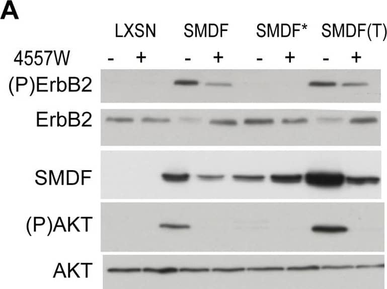 SMDF transforms via ErbB receptor signalling.(A) Western blot analysis of indicated proteins in NSLT cells expressing SMDF, SMDF* (point mutant incapable of binding ErbB receptors) or control vector (LXSN), and SMDF(T) cells derived from SMDF tumours in the absence or presence of the ErbB-2 inhibitor, 4557W (40 nM). (B) Cell counts of triplicate wells in the presence or absence of the indicated concentrations of 4557W −/+ S.D.. Figure is representative of 3 independent experiments. (C) Number of colonies formed in soft agar assays of NSLT cells expressing SMDF, Ras or control vector LXSN in the absence or presence of the indicated inhibitors. U0126 (UO), LY294002 (LY) and the ErbB inhibitor (ErbBI). 12 fields were counted per well with the results shown as average/well −/+ S.D.. Results are representative of two separate experiments (D) Soft agar assays of NSLT cells infected with SMDF, SMDF* or control vector (E) 105 NSLT cells expressing SMDF, Ras or control vector (LXSN) were seeded in triplicate into 6 well dishes and counted at 72 h. The inhibitors U0126 (20 µM), LY294002 (20 µM) or control vehicle were added where indicated at 36 hours. Western blot analysis of total lysates from NSLT cells expressing SMDF or control vector (LXSN). (F) Western blot analysis of total lysates from NSLT cells expressing SMDF or control vector (LXSN) collected 3 (preconfluent), 6 and 9 days after seeding. Plates were medium changed daily. (G) Western blot analysis of total lysates from NSLT cells expressing SMDF, Ras or control vector (LXSN) in attached (att) or anchorage-independent conditions (sus). Image collected and cropped by CiteAb from the following open publication (//pubmed.ncbi.nlm.nih.gov/20668675), licensed under a CC-BY license. Not internally tested by R&D Systems.