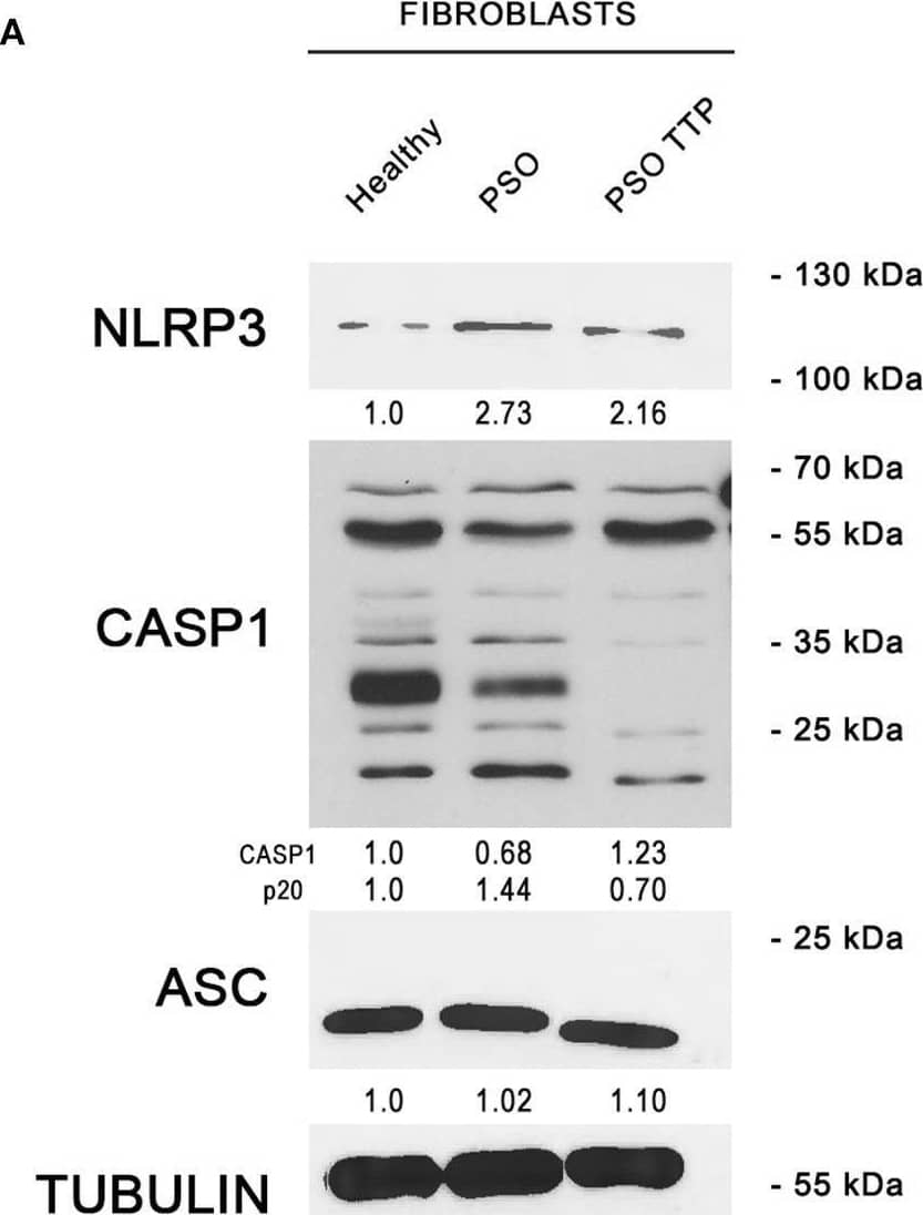 (A) NLRP3 inflammasome protein levels are displayed by Western blot in three different fibroblast cell populations: healthy fibroblasts (Healthy), psoriatic fibroblasts (PSO), and psoriatic fibroblasts infected with a pRRL-TTP-overexpressing vector (PSO TTP). Tubulin was used as loading control. (B) TTP overexpression is shown in psoriatic fibroblast sample. Actin was used as loading control. (C) Inflammasome components variation pattern already seen in primary fibroblasts is maintained in the HaCaT keratinocyte cell line. Actin was used as loading control. (D) pRRL-empty vector was used to obtain the overexpression vector pRRL-TTP, by substitution of  delta NGFR sequence with TTP cDNA. Image collected and cropped by CiteAb from the following open publication (//pubmed.ncbi.nlm.nih.gov/33585499), licensed under a CC-BY license. Not internally tested by R&D Systems.