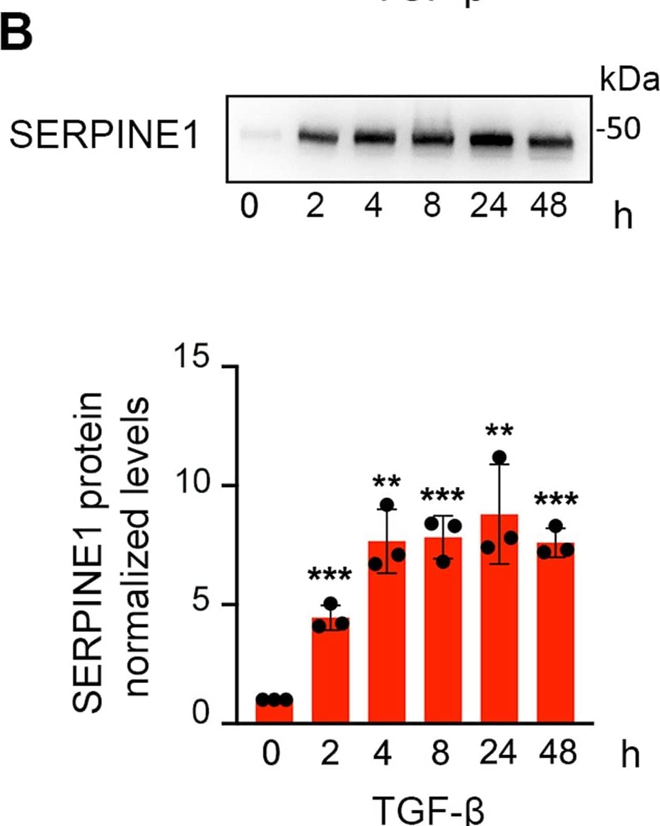 Serpine1 expression in TGF-beta –treated NMuMG cells. Relative levels of mRNA Serpine1 (A) and protein SERPINE1 (B) in cells treated with TGF-beta  at the indicated times. A representative immunoblotting of SERPINE1 is shown. Quantification of Serpine1 and SERPINE1 in three independent experiments is shown. Error bars represent S.D. ***p < 0.001, **p < 0.01 by two-tailed Student´s t test. Protein-loading normalization was performed by measuring total protein directly on the membrane using the criterion stain-free gel imaging system. Image collected and cropped by CiteAb from the following open publication (//www.nature.com/articles/s41420-024-01886-8), licensed under a CC-BY license. Not internally tested by R&D Systems.