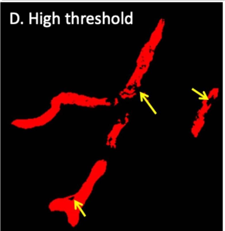 Immunohistochemistry Laminin alpha 4 Antibody [Unconjugated]