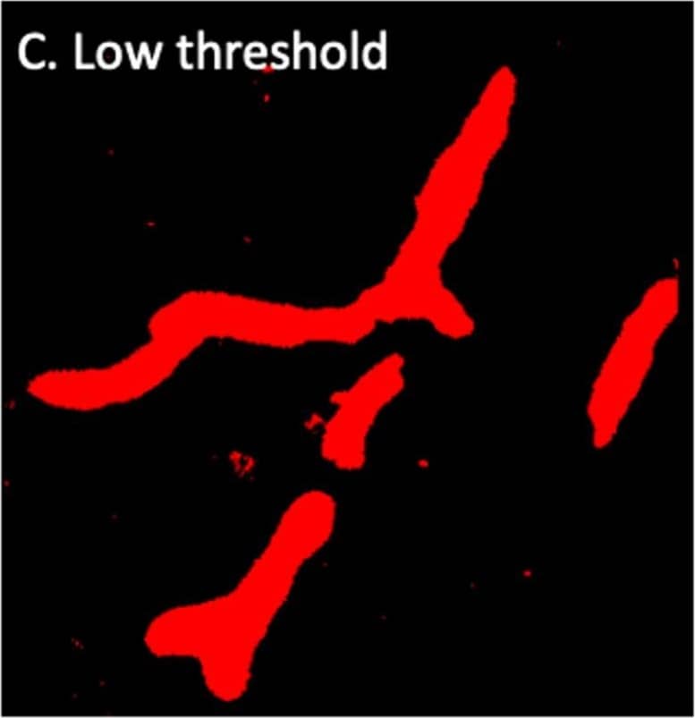 Laminin-alpha 4 staining provides a clear indication of the BBB (A), however pixel intensity varies considerably. Intellesis is able to recognise high and low intensity pixels accurately (B), unlike classical intensity thresholds which result in either too much (C) or too little (D) capillary segmentation. Image collected and cropped by CiteAb from the following open publication (//pubmed.ncbi.nlm.nih.gov/33935625), licensed under a CC-BY license. Not internally tested by R&D Systems.