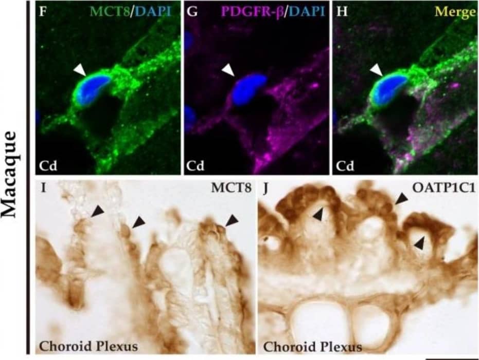 Expression of MCT8 and OATP1C1 in blood vessels and brain barriers in the human and macaque basal ganglia and adjacent choroid plexus. (A) Representative brightfield photomicrograph shows immunostaining for MCT8 in the human putamen. Note that an MCT8 immunopositive signal is observed along the capillary wall (red arrowhead), fibers (green arrowhead), and “bump-on-a-log” morphology pericytelike cells (white arrowhead). (B–H) Representative confocal microscope compositions from multiple-stained sections for MCT8 (green), the endothelial marker UEA-I (red), and the vascular and pericyte biomarker PDGFR-beta  (purple) in human and macaque caudate nucleus. Merged image (E,H) shows the colocalization of all signals. (B–E) Coexpression of MCT8, UEA-I, and PDGFR-beta  is observed in a vessel, while coexpression of MCT8 and PDGFR-beta  but not UEA-I is observed in a capillary-associated pericyte (white arrowheads) in humans. (F–H) Coexpression of MCT8 and PDGFR-beta  in a vessel and pericytelike cells (white arrowheads) in macaques. Counterstaining with DAPI (blue) shows nuclei of all cells. (I,J) Representative brightfield photomicrographs show immunostaining for MCT8 (I) and OATP1C1 (J) in the macaque choroid plexus at the lateral ventricle. Black arrowheads point to ependymocytes. Cd: caudate nucleus, Put: putamen, PDGFR-beta : platelet-derived growth factor receptor-beta , UEA-I: Ulex europaeus agglutinin-I. Scale bar = 10 μm (A–H) and 50 μm (I,J). Image collected and cropped by CiteAb from the following open publication (//pubmed.ncbi.nlm.nih.gov/37298594), licensed under a CC-BY license. Not internally tested by R&D Systems.