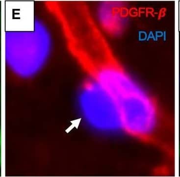 Pericyte soma on WM capillaries demonstrated by immunofluorescence. A–F. PDGFR‐ beta  (red) and COL4 (green) immunofluorescence staining with nuclei (DAPI) (blue). A,B. Low‐ and high‐power images showing capillary segments (arrowheads) with overlapping PDGFR‐ beta  (red), COL4 (green) and DAPI (blue). C. Same vessel segment as B with PDGFR‐ beta  (red) and COL4 (green); D. COL4 (green) and DAPI (blue); E. PDGFR‐ beta  (red) and DAPI (blue). F. Another capillary segment with PDGFR‐ beta  (red), COL4 (green) and DAPI (blue) clearly showing pericyte cell body. G–J. Images taken by a confocal microscope showing pericyte cell bodies (arrows) with nuclear stain (DAPI). Capillaries and pericyte processes are revealed by COL4 and PDGFR‐ beta  (red) immunoreactivities. Magnification bars: A = 50 µm, F, J = 10 µm. Image collected and cropped by CiteAb from the following open publication (//pubmed.ncbi.nlm.nih.gov/32705757), licensed under a CC-BY license. Not internally tested by R&D Systems.