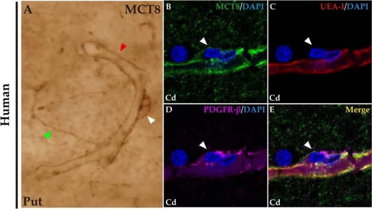 Expression of MCT8 and OATP1C1 in blood vessels and brain barriers in the human and macaque basal ganglia and adjacent choroid plexus. (A) Representative brightfield photomicrograph shows immunostaining for MCT8 in the human putamen. Note that an MCT8 immunopositive signal is observed along the capillary wall (red arrowhead), fibers (green arrowhead), and “bump-on-a-log” morphology pericytelike cells (white arrowhead). (B–H) Representative confocal microscope compositions from multiple-stained sections for MCT8 (green), the endothelial marker UEA-I (red), and the vascular and pericyte biomarker PDGFR-beta  (purple) in human and macaque caudate nucleus. Merged image (E,H) shows the colocalization of all signals. (B–E) Coexpression of MCT8, UEA-I, and PDGFR-beta  is observed in a vessel, while coexpression of MCT8 and PDGFR-beta  but not UEA-I is observed in a capillary-associated pericyte (white arrowheads) in humans. (F–H) Coexpression of MCT8 and PDGFR-beta  in a vessel and pericytelike cells (white arrowheads) in macaques. Counterstaining with DAPI (blue) shows nuclei of all cells. (I,J) Representative brightfield photomicrographs show immunostaining for MCT8 (I) and OATP1C1 (J) in the macaque choroid plexus at the lateral ventricle. Black arrowheads point to ependymocytes. Cd: caudate nucleus, Put: putamen, PDGFR-beta : platelet-derived growth factor receptor-beta , UEA-I: Ulex europaeus agglutinin-I. Scale bar = 10 μm (A–H) and 50 μm (I,J). Image collected and cropped by CiteAb from the following open publication (//pubmed.ncbi.nlm.nih.gov/37298594), licensed under a CC-BY license. Not internally tested by R&D Systems.