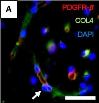 Pericyte soma on WM capillaries demonstrated by immunofluorescence. A–F. PDGFR‐ beta  (red) and COL4 (green) immunofluorescence staining with nuclei (DAPI) (blue). A,B. Low‐ and high‐power images showing capillary segments (arrowheads) with overlapping PDGFR‐ beta  (red), COL4 (green) and DAPI (blue). C. Same vessel segment as B with PDGFR‐ beta  (red) and COL4 (green); D. COL4 (green) and DAPI (blue); E. PDGFR‐ beta  (red) and DAPI (blue). F. Another capillary segment with PDGFR‐ beta  (red), COL4 (green) and DAPI (blue) clearly showing pericyte cell body. G–J. Images taken by a confocal microscope showing pericyte cell bodies (arrows) with nuclear stain (DAPI). Capillaries and pericyte processes are revealed by COL4 and PDGFR‐ beta  (red) immunoreactivities. Magnification bars: A = 50 µm, F, J = 10 µm. Image collected and cropped by CiteAb from the following open publication (//pubmed.ncbi.nlm.nih.gov/32705757), licensed under a CC-BY license. Not internally tested by R&D Systems.