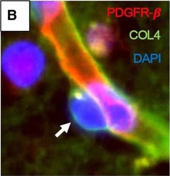 Pericyte soma on WM capillaries demonstrated by immunofluorescence. A–F. PDGFR‐ beta  (red) and COL4 (green) immunofluorescence staining with nuclei (DAPI) (blue). A,B. Low‐ and high‐power images showing capillary segments (arrowheads) with overlapping PDGFR‐ beta  (red), COL4 (green) and DAPI (blue). C. Same vessel segment as B with PDGFR‐ beta  (red) and COL4 (green); D. COL4 (green) and DAPI (blue); E. PDGFR‐ beta  (red) and DAPI (blue). F. Another capillary segment with PDGFR‐ beta  (red), COL4 (green) and DAPI (blue) clearly showing pericyte cell body. G–J. Images taken by a confocal microscope showing pericyte cell bodies (arrows) with nuclear stain (DAPI). Capillaries and pericyte processes are revealed by COL4 and PDGFR‐ beta  (red) immunoreactivities. Magnification bars: A = 50 µm, F, J = 10 µm. Image collected and cropped by CiteAb from the following open publication (//pubmed.ncbi.nlm.nih.gov/32705757), licensed under a CC-BY license. Not internally tested by R&D Systems.