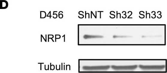 ST6GAL1 targeting decreases levels of a subset of N-glycoproteins that are known BTIC regulators.(A) Schematic of proteomic analysis of D456 BTICs with and without ST6GAL1 KD (n = 4 for each group of shNT, sh32, and sh33). IB with samples independent of the proteomic analysis verified that successful targeting ST6GAL1 resulted in decreased (B) PDGFRB, (C) ALCAM, and (D) NRP1 protein. (E) Schematic of pulldown using SNA-bound Agarose beads. (F) SNA pulldown and protein A/G bound agarose beads as a control demonstrated that PDGFRB, ALCAM, and NRP1 were targets for  alpha 2,6 sialylation. (G) SNA pulldown of D456 PDX cells with ST6GAL1 KD compared with NT, illustrating differential pulldown of PDGFRB. (H) PDGF-BB–induced (10 minutes) activation of PDGFRB in D456 GBM PDX cells with ST6GAL1 KD compared with NT; IB for p-PDGFRB and total PDGFRB. The experiments were repeated in at least 3 independent biological replicates. Data from 1 representative experiment are shown. Image collected and cropped by CiteAb from the following open publication (//pubmed.ncbi.nlm.nih.gov/36345944), licensed under a CC-BY license. Not internally tested by R&D Systems.