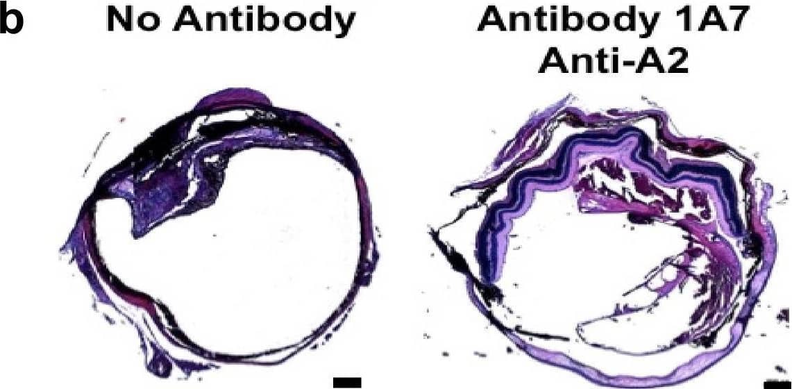 Effect of anti-annexin A2 IgG pretreatment on dispase-induced PVR.a, b Wild type C57Bl/6 mice were pretreated with an anterior chamber injection of anti-A2 IgG (1A7 or 2E6), control IgG (1D4), or PBS, two days prior to intravitreal dispase injection. At 2 (a) and 4 (b) weeks, the eyes were harvested, fixed, embedded, sectioned, and stained with H and E. Scale bars for (a and b) are 200 um. PVR histology (c) and RPE migration (d) scores were recorded by trained, masked observers. Shown for (c and d) are mean ± SE, n = 7 animals/group. p values were determined by unpaired one-way ANOVA and the post hoc Tukey test. Source data for (c and d), are provided as a Source File. Image collected and cropped by CiteAb from the following open publication (//pubmed.ncbi.nlm.nih.gov/39384746), licensed under a CC-BY license. Not internally tested by R&D Systems.