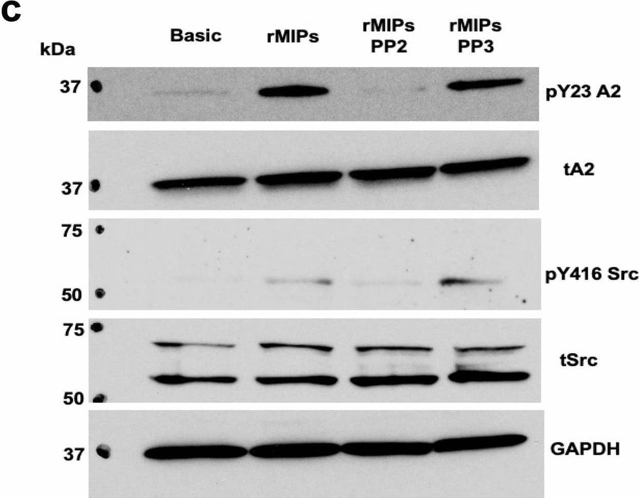 MIPs induce Src-dependent tyrosine phosphorylation and translocation of A2 to the cell surface. A ARPE-19 cells were incubated for 18 h with basic medium (Basic), activated THP-1 cell conditioned medium (CM), or THP-1 CM with RPE CM with or without addition of anti-human MIP-1 alpha / beta  or non-immune IgG. Cell surface A2 (sA2) was labeled using membrane impermeable biotinylation and captured with NeutrAvidin agarose beads. Labeled cell surface proteins were resolved by SDS-PAGE and cell surface (sA2) and total cell lysate A2 (tA2) probed by immunoblot with mouse (BD #610069) or rabbit (Cell Signaling #8235) anti-A2 IgG. b Pixel density of immunoblotted bands from 3-5 separate experiments were quantified and normalized to the unstimulated sample (Basic). c ARPE-19 cells were incubated with basic media with or without recombinant human MIP-1 alpha / beta  (MIPs, 200 ng/ml each), and with or without the Src kinase inhibitor PP2 or its control PP3 (10 µM, 3 h). Cell lysates were probed for pY23-A2, tA2, pY416 activated Src, total Src (tSrc), and GAPDH, as a loading control. d Pixel density of immunoblotted bands from 3-6 separate experiments were quantified and normalized to the unstimulated sample (Basic). e ARPE-19 cells were incubated with or without recombinant human MIP-1 alpha / beta  (MIPs, 200 ng/ml each) in the presence or absence of PP2 or PP3, as in (c). f Pixel density of immunoblotted bands from 3–7 separate experiments were quantified and normalized to the unstimulated sample (Basic). Shown for (b, d, f) are mean values ± SE, with p values determined by unpaired one-way ANOVA and the post hoc Tukey test. Source data for (b, d, and f) are provided as a Source File. Image collected and cropped by CiteAb from the following open publication (//pubmed.ncbi.nlm.nih.gov/39384746), licensed under a CC-BY license. Not internally tested by R&D Systems.