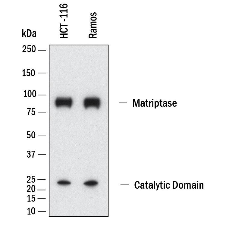 Western Blot Matriptase/ST14 Antibody [Unconjugated]