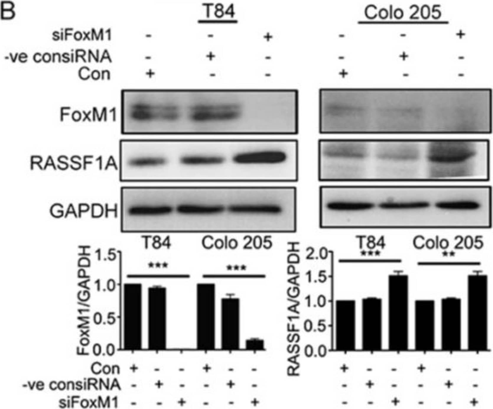 RASSF1A regulation is dependent on FoxM1. T84 and Colo 205 cells were transfected with plasmid for overexpression of FoxM1. (A) Cell lysates were analyzed by immunoblot and quantified by densitometry for expression of FoxM1, RASSF1A. Expression is normalized against GAPDH. The right panel of (A) represents the densitometric analysis of FoxM1 and RASSF1A. (B) T84 and Colo 205 cells were transfected with siRNA for FoxM1 or control siRNA for 48 h. Cell lysates were evaluated for FoxM1 ((B), 1st lane), RASSF1A ((B), 2nd lane) by immunoblot and quantified by densitometry. The results are from three independent experiments. (** p < 0.01, *** p < 0.001). Image collected and cropped by CiteAb from the following publication (//pubmed.ncbi.nlm.nih.gov/30744076), licensed under a CC-BY license. Not internally tested by R&D Systems.