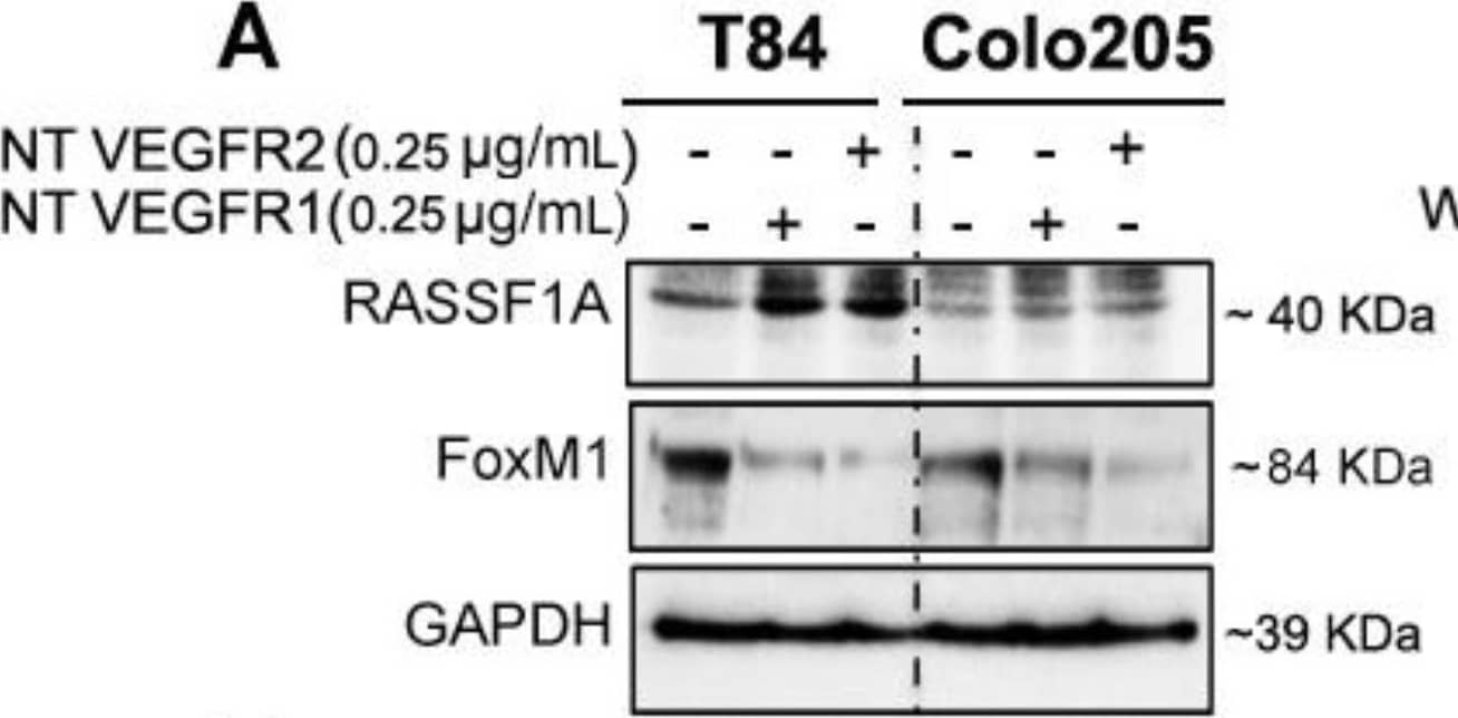 Neutralizing VEGF receptor antibodies and Akt inhibition upregulates RASSF1A and downregulates FoxM1 in mCRC. T84 and Colo 205 cells were treated with VEGF receptor 1 and VEGFR2 as indicated before (see Section 2.3). Protein expression from cell lysates was determined by immunoblotting for RASSF1A ((A), upper panel) and FoxM1 ((A), middle panel). Densitometry analysis was performed and normalyzed with GAPDH expression to demonstrate significant upregulation for RASSF1A (B) and downregulation of FoxM1 in the presence of neutralized (NT) VEGFR1 or VEGFR2 (C). (D,E) T84 and Colo 205 cells were treated with Akt inhibitor (wortmannin) with different doses (0–1 µM) for 24 h. Cell lysates were analyzed for pAkt (1st lane), total Akt (2nd lane), RASSF1A (3rd lane) expression by immunoblot analysis and quantified by densitometry (F,G). The results are from three independent experiments. (* p < 0.05, ** p < 0.01, *** p < 0.001). Image collected and cropped by CiteAb from the following publication (//pubmed.ncbi.nlm.nih.gov/30744076), licensed under a CC-BY license. Not internally tested by R&D Systems.