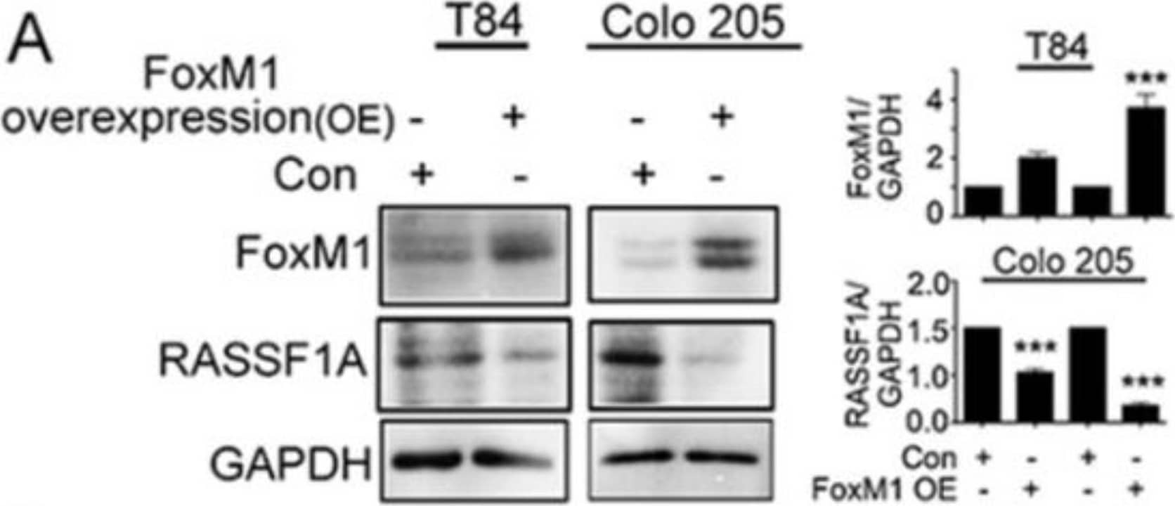 RASSF1A regulation is dependent on FoxM1. T84 and Colo 205 cells were transfected with plasmid for overexpression of FoxM1. (A) Cell lysates were analyzed by immunoblot and quantified by densitometry for expression of FoxM1, RASSF1A. Expression is normalized against GAPDH. The right panel of (A) represents the densitometric analysis of FoxM1 and RASSF1A. (B) T84 and Colo 205 cells were transfected with siRNA for FoxM1 or control siRNA for 48 h. Cell lysates were evaluated for FoxM1 ((B), 1st lane), RASSF1A ((B), 2nd lane) by immunoblot and quantified by densitometry. The results are from three independent experiments. (** p < 0.01, *** p < 0.001). Image collected and cropped by CiteAb from the following publication (//pubmed.ncbi.nlm.nih.gov/30744076), licensed under a CC-BY license. Not internally tested by R&D Systems.