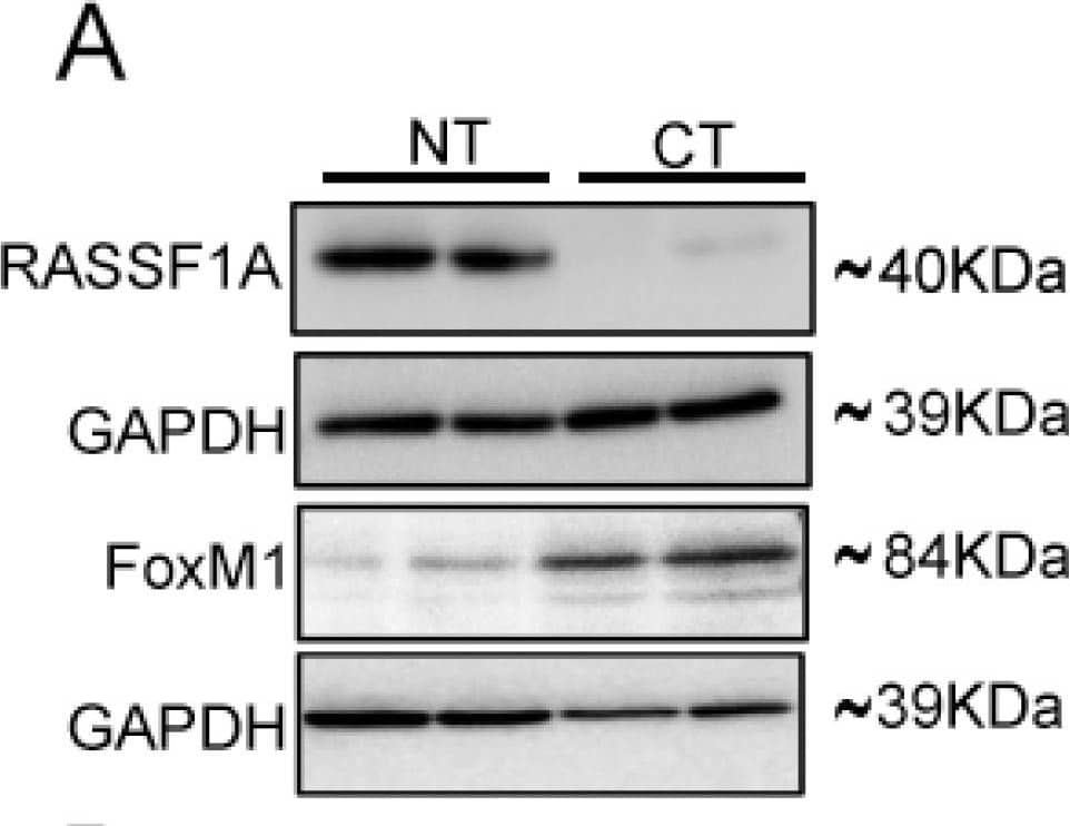 FoxM1 and RASSF1A expression is inversely co-related in colon cancer tissues. (A) Tissue extranction from both normal and colon cancer patient for monitoring the translational level of FoxM1 and RASSF1A by immunoblot. Quantification of RASSF1A (B) and FoxM1 (C) by scanning densitometry. GAPDH was used as a loading control. (D) T84 and Colo 205 cells were treated with or without AGP IC50 (45 µM) for 48 h. Cell lysates were analyzed by Western blot for FoxM1 and GAPDH expression. (E) Quantitative estimations of FoxM1 levels determined by densitometry measurements of western blots from three independent experiments after normalization with GAPDH (p < 0.001). T84 and Colo 205 cells were treated with or without AGP as indicated before and the transcriptional level were determined by qRT-PCR for (F) FoxM1 and (G) PTTG1. Bar graphs show quantitative results normalized to GAPDH mRNA levels. Results are from three independent experiments and statistical significance was determined using one way-ANOVA followed Bonferroni test. (* p < 0.05, ** p < 0.01, *** p < 0.001). Image collected and cropped by CiteAb from the following publication (//pubmed.ncbi.nlm.nih.gov/30744076), licensed under a CC-BY license. Not internally tested by R&D Systems.