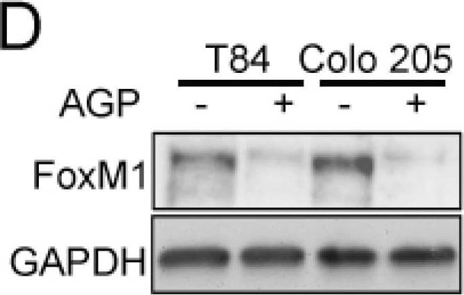 FoxM1 and RASSF1A expression is inversely co-related in colon cancer tissues. (A) Tissue extranction from both normal and colon cancer patient for monitoring the translational level of FoxM1 and RASSF1A by immunoblot. Quantification of RASSF1A (B) and FoxM1 (C) by scanning densitometry. GAPDH was used as a loading control. (D) T84 and Colo 205 cells were treated with or without AGP IC50 (45 µM) for 48 h. Cell lysates were analyzed by Western blot for FoxM1 and GAPDH expression. (E) Quantitative estimations of FoxM1 levels determined by densitometry measurements of western blots from three independent experiments after normalization with GAPDH (p < 0.001). T84 and Colo 205 cells were treated with or without AGP as indicated before and the transcriptional level were determined by qRT-PCR for (F) FoxM1 and (G) PTTG1. Bar graphs show quantitative results normalized to GAPDH mRNA levels. Results are from three independent experiments and statistical significance was determined using one way-ANOVA followed Bonferroni test. (* p < 0.05, ** p < 0.01, *** p < 0.001). Image collected and cropped by CiteAb from the following publication (//pubmed.ncbi.nlm.nih.gov/30744076), licensed under a CC-BY license. Not internally tested by R&D Systems.