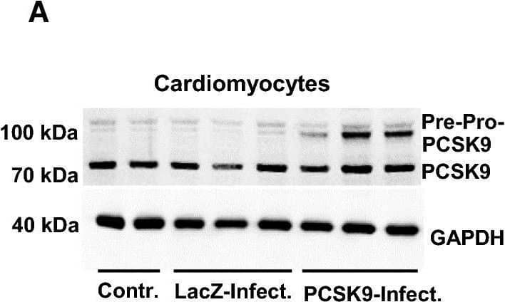 Infection of cardiomyocytes with human PCSK9. Serum-free cultured adult rat ventricular cardiomyocytes were infected with hPCSK9. Infection of cardiomyocytes with LacZ served as control. After 24 h, load free cell shortening was measured (cells paced at 2 Hz). a Representative immunoblot indicating the successful transfection of cardiomyocytes with hPCSK9. b Quantification of Western Blot shown in (a). c Load free cell-shortening expressed as  delta L/L (%), (d) contraction velocity (µm/s) (e) and relaxation velocity (µm/s) of 89 (LacZ) and 90 (PCSK9) cells (10 independent experiments with intraassay variability p > 0.05). Statistical analysis was performed by Mann–Whitney test. *p ≤ 0.05. Data are mean ± SD Image collected and cropped by CiteAb from the following open publication (//pubmed.ncbi.nlm.nih.gov/33169229), licensed under a CC-BY license. Not internally tested by R&D Systems.