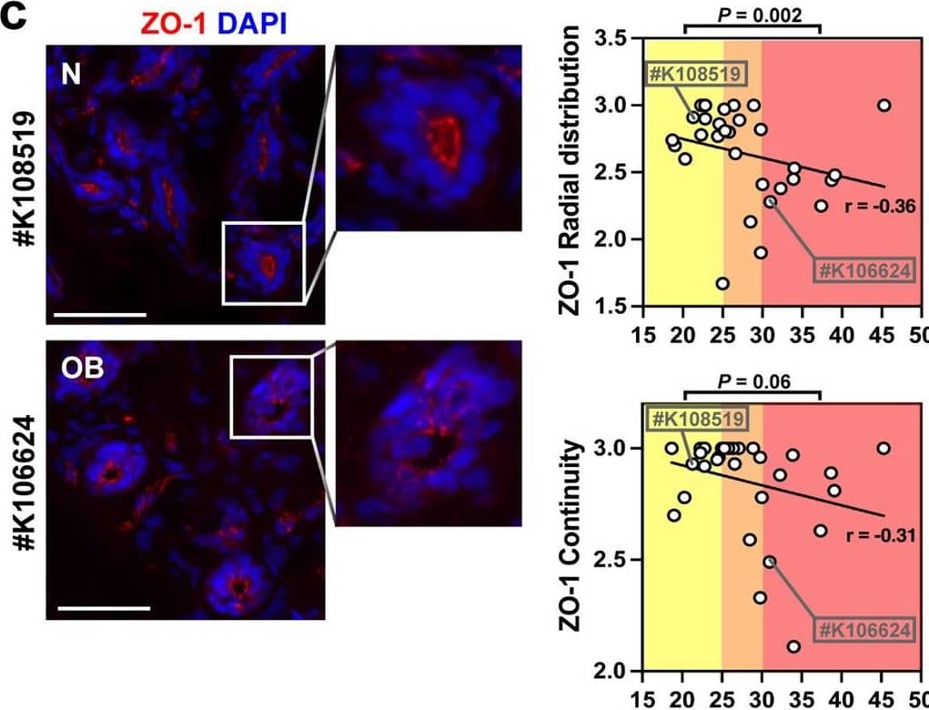 Effect of the body mass index on epithelial polarity and proliferation in normal breast tissues. A Leptin and adiponectin levels as a function of BMI in serum from women who donated breast tissue specimens to the Komen Tissue Bank. Spearman correlation coefficients (r) are indicated with corresponding P values. b Cross-sectional size of adipocytes in breast tissue sections from KTB donors. r, Pearson’s correlation coefficient. c ZO-1 radial distribution and continuity in breast tissue sections as a function of BMI. Microscopy images from two different donors are shown for illustration. Cell nuclei were stained with DAPI. Statistical comparisons (normal weight vs. obesity) with Mann Whitney test. d Relative proportion of adipose tissue as a function of BMI. r, Pearson’s coefficient. e ZO-1 score (average of continuity and radial distribution) as a function of the adipose content of the tissues. r, Pearson’s coefficient. f Quantification of epithelial structures (ducts, lobules) with ≥1 Ki67-positive cells according to BMI categories. Representative immunostaining images are shown, with arrowheads pointing to Ki67-positive nuclei. Antibodies against NuMA were used as staining control. *P < 0.05 (ANOVA and Fischer’s LSD test). g Average number of epithelial cell layers in breast epithelia from different BMI categories, assessed on H&E images. *P < 0.05 (Kruskal–Wallis and Dunn’s test). Averages are shown on bar graphs. Scale bars: 50 µm. N normal weight, OW overweight, OB obese. Each symbol on the graphs represents a KTB donors. Image collected and cropped by CiteAb from the following open publication (//pubmed.ncbi.nlm.nih.gov/37160903), licensed under a CC-BY license. Not internally tested by R&D Systems.