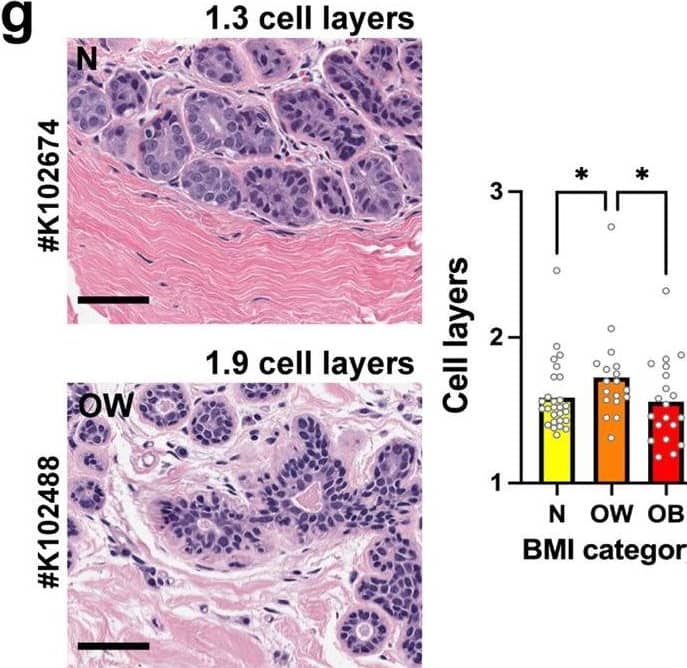 Effect of the body mass index on epithelial polarity and proliferation in normal breast tissues. A Leptin and adiponectin levels as a function of BMI in serum from women who donated breast tissue specimens to the Komen Tissue Bank. Spearman correlation coefficients (r) are indicated with corresponding P values. b Cross-sectional size of adipocytes in breast tissue sections from KTB donors. r, Pearson’s correlation coefficient. c ZO-1 radial distribution and continuity in breast tissue sections as a function of BMI. Microscopy images from two different donors are shown for illustration. Cell nuclei were stained with DAPI. Statistical comparisons (normal weight vs. obesity) with Mann Whitney test. d Relative proportion of adipose tissue as a function of BMI. r, Pearson’s coefficient. e ZO-1 score (average of continuity and radial distribution) as a function of the adipose content of the tissues. r, Pearson’s coefficient. f Quantification of epithelial structures (ducts, lobules) with ≥1 Ki67-positive cells according to BMI categories. Representative immunostaining images are shown, with arrowheads pointing to Ki67-positive nuclei. Antibodies against NuMA were used as staining control. *P < 0.05 (ANOVA and Fischer’s LSD test). g Average number of epithelial cell layers in breast epithelia from different BMI categories, assessed on H&E images. *P < 0.05 (Kruskal–Wallis and Dunn’s test). Averages are shown on bar graphs. Scale bars: 50 µm. N normal weight, OW overweight, OB obese. Each symbol on the graphs represents a KTB donors. Image collected and cropped by CiteAb from the following open publication (//pubmed.ncbi.nlm.nih.gov/37160903), licensed under a CC-BY license. Not internally tested by R&D Systems.