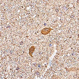 Immunohistochemistry Park7/DJ-1 Antibody [Unconjugated]
